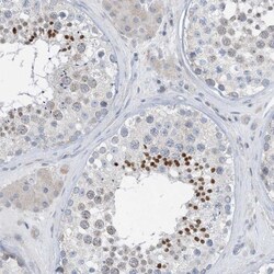 BTBD8 Antibody, Novus Biologicals 25 &mu;L, Unlabeled:Antibodies, Polyclonal